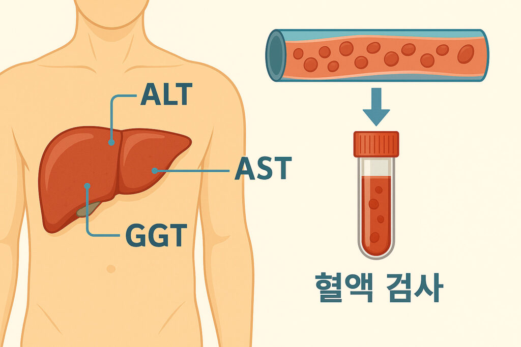 간 기능과 ALT AST 수치 구조도